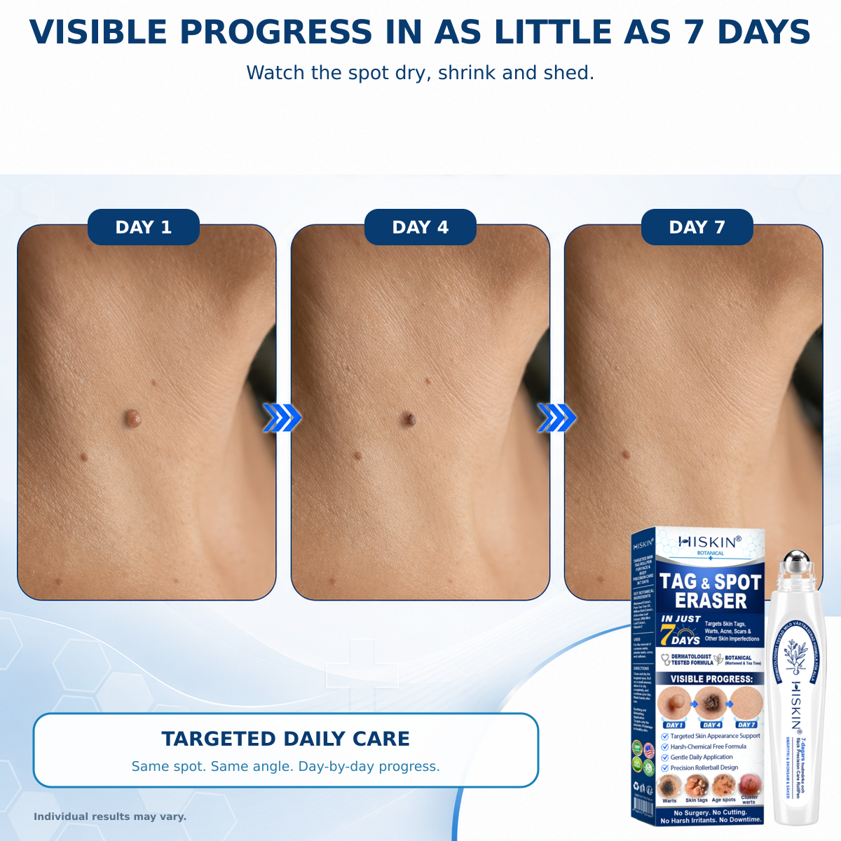 HISKIN® 7-Day Skin Tag & Spot Care Roller